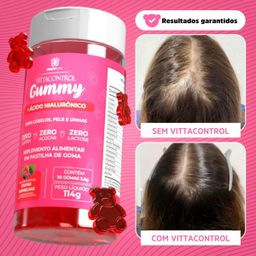 Vitamina Capilar Gummy + Ácido Hialurônico Vittacontrol ZERO SUPER CONCENTRADO
